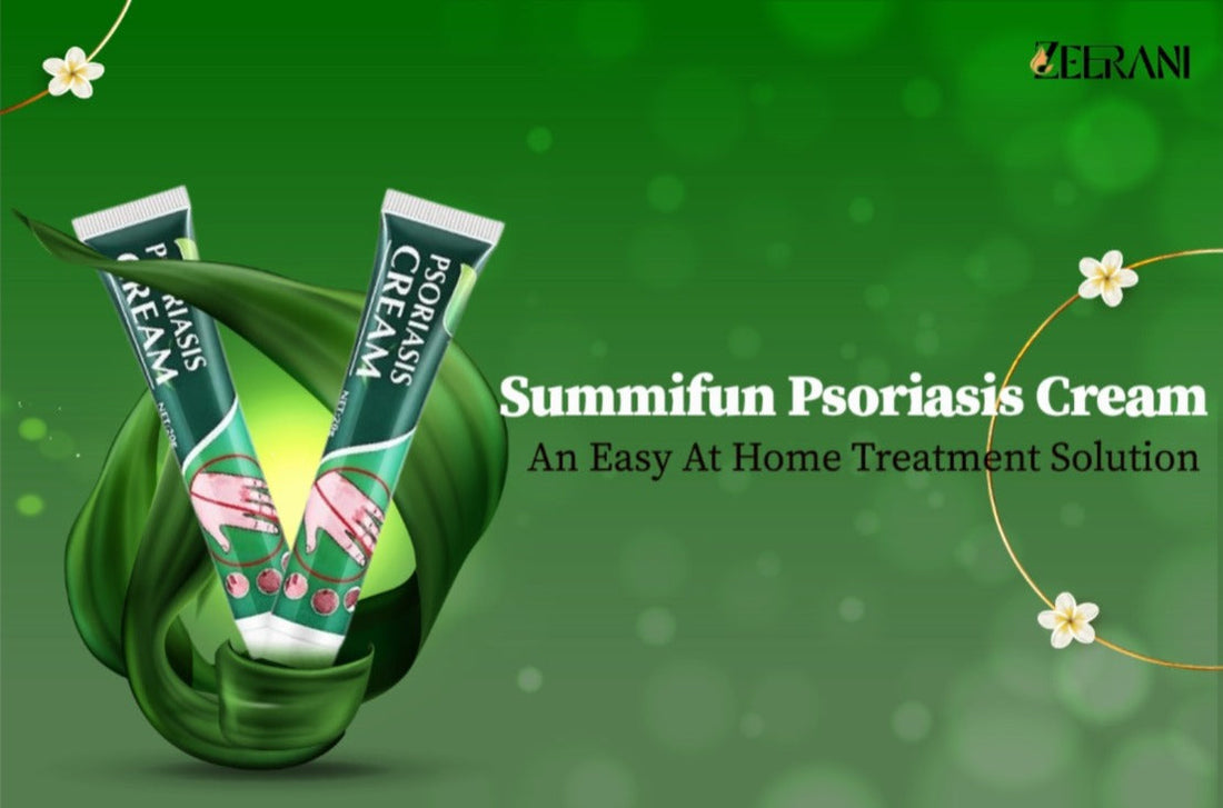 Summifun Psoriasis Cream – An Easy At-Home Treatment Solution