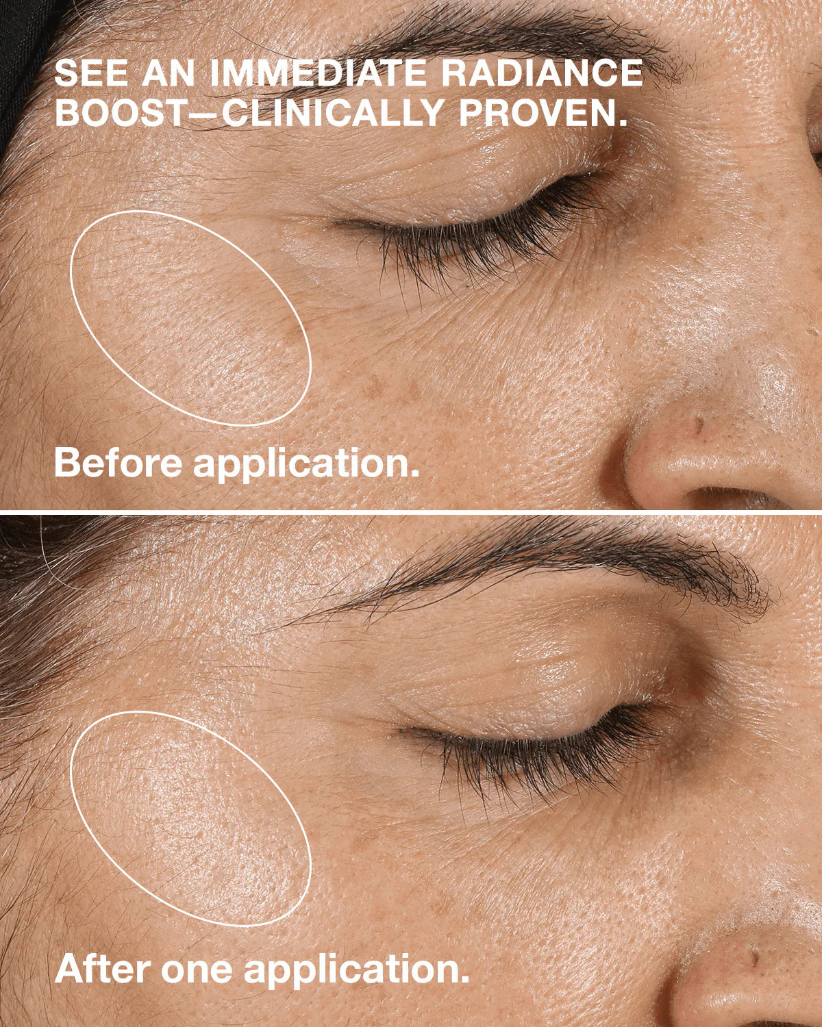 Clinique - Clarifying Lotion (Original) ©