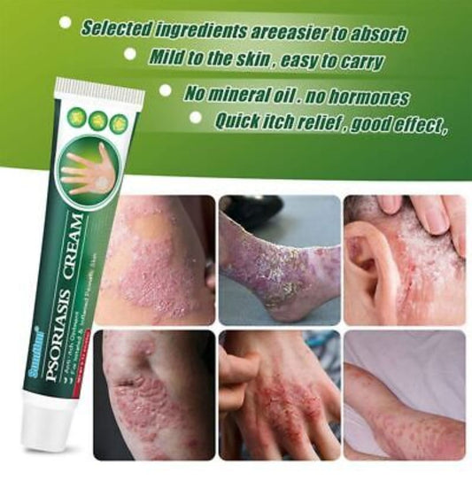 Summifun - Psoriasis Cream (Original)